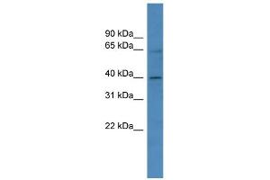 WB Suggested Anti-ZNF579 Antibody Titration:  0. (ZNF579 Antikörper  (C-Term))
