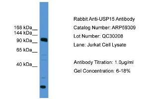 WB Suggested Anti-USP15  Antibody Titration: 0. (USP15 Antikörper  (C-Term))