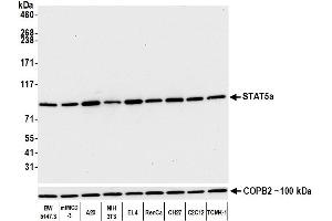 Western Blotting (WB) image for anti-Signal Transducer and Activator of Transcription 5A (STAT5A) (AA 744-794) antibody (ABIN7454017) (Rekombinanter STAT5A Antikörper  (AA 744-794))