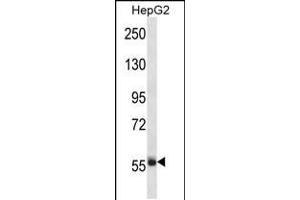 Western blot analysis in HepG2 cell line lysates (35ug/lane). (Sp3 Antikörper  (AA 292-321))