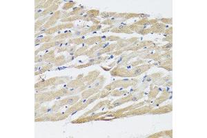 Immunohistochemistry (Paraffin-embedded Sections) (IHC (p)) image for anti-Natriuretic Peptide A (NPPA) (AA 26-151) antibody (ABIN3022234)