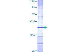 Image no. 1 for N-Acetylglucosaminidase, alpha (NAGLU) (AA 644-742) protein (GST tag) (ABIN1311939) (NAGLU Protein (AA 644-742) (GST tag))