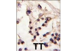 Formalin-fixed and paraffin-embedded human testis tissue reacted with TESK2 antibody (Center) f , which was peroxidase-conjugated to the secondary antibody, followed by DAB staining. (TESK2 Antikörper  (AA 210-240))