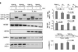 ROS and HMGB1 distribution in starvation-stressed TBP/Q36~79 293 cells. (Histone H3.3B Antikörper  (full length))