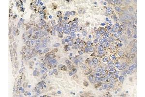 anti-V-Rel Reticuloendotheliosis Viral Oncogene Homolog B (RELB) (pSer573) antibody