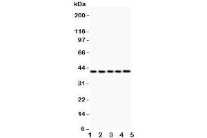 Western blot testing of CXCR6 antibody and Lane 1: rat brain;  2: (r) testis;  3: (r) spleen;  4: mouse brain;  5: (m) testis;  Expected/observed size ~39KD (CXCR6 Antikörper  (C-Term))