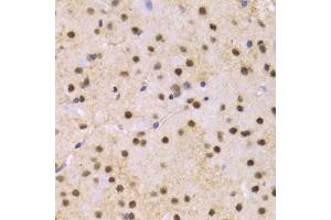 Immunohistochemistry of paraffin-embedded mouse brain using SNRPE Antibody (ABIN1876676) at dilution of 1:100 (40x lens). (SNRPE Antikörper)