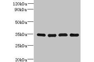 Western blot All lanes: DNAJC17 antibody at 16 μg/mL Lane 1: A431 whole cell lysate Lane 2: Hela whole cell lysate Lane 3: Raji whole cell lysate Lane 4: HepG2 whole cell lysate Secondary Goat polyclonal to rabbit IgG at 1/10000 dilution Predicted band size: 35 kDa Observed band size: 35 kDa (DNAJC17 Antikörper  (AA 1-304))