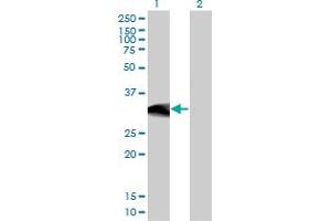 Western Blot analysis of BCL11A expression in transfected 293T cell line by BCL11A monoclonal antibody (M03), clone 3D9. (BCL11A Antikörper  (AA 1-88))