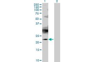 Western Blot analysis of RAB7B expression in transfected 293T cell line by RAB7B MaxPab polyclonal antibody. (RAB7B Antikörper  (AA 1-199))