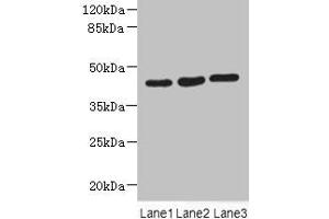 Western blot All lanes: MAPKAPK3 antibody at 4. (MAPKAP Kinase 3 Antikörper  (AA 1-240))