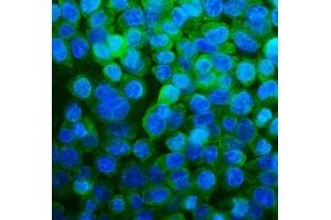 IF analysis of RPL13A using anti-RPL13A antibody (ABIN7600471). (RPL13A Antikörper  (AA 2-203))