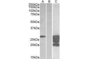 HEK293 lysate (10 µg protein in RIPA buffer) overexpressing Human GM2A with DYKDDDDK tag probed with AP23748PU-N (1. (GM2A Antikörper  (Internal Region))