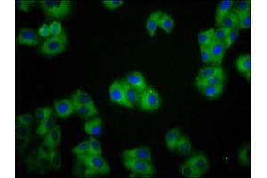 Immunofluorescence (IF) image for anti-Cadherin 1, Type 1, E-Cadherin (Epithelial) (CDH1) (AA 23-621) antibody (ABIN7146195)