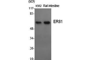 Western Blot (WB) analysis of specific cells using ER81 Polyclonal Antibody. (ETV1 Antikörper  (N-Term))