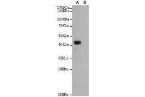 Western blot of Wnt5b A) transfected and (B) untransfected CHO-K1 cell lysate with WNT5B antibody at 1:1000. (WNT5B Antikörper)