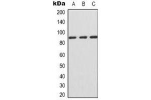 Western blot analysis of IFNGR1 expression in Jurkat (A), HepG2 (B), COS7 (C) whole cell lysates. (IFNGR1 Antikörper  (C-Term))
