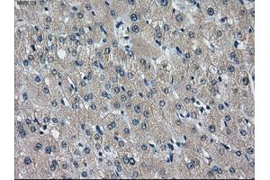 Immunohistochemical staining of paraffin-embedded liver tissue using anti-IDH3Amouse monoclonal antibody.