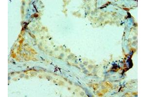 Immunohistochemistry of paraffin-embedded human testis tissue using ABIN7148221 at dilution of 1:100 (COL1A1 Antikörper  (AA 521-680))