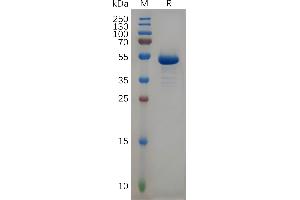 CD99 (CD99) (AA 23-122) protein (Fc Tag)