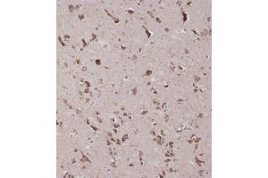 Immunohistochemical analysis of C on paraffin-embedded Human brain tissue was performed on the Leica®BOND RXm. (CBS Antikörper  (AA 301-330))