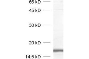 dilution: 1 : 1000, sample: crude synaptosomal fraction of rat brain (P2) (VAMP2 Antikörper  (AA 2-17))