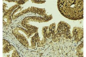 ABIN6276466 at 1/100 staining Mouse colon tissue by IHC-P. (MTAP Antikörper  (Internal Region))