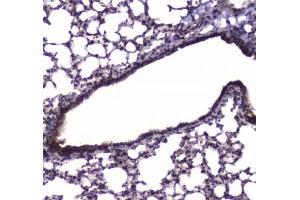 IHC testing of FFPE mouse lung tissue with NFIB antibody at 1ug/ml. (NFIB Antikörper)
