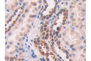 Immunohistochemistry (IHC) image for anti-Fibulin 1 (FBLN1) (AA 176-398) antibody (ABIN7434947)