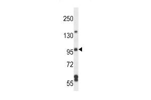 SGEF Antibody (Center) (ABIN657248 and ABIN2846346) western blot analysis in NCI- cell line lysates (35 μg/lane). (SGEF Antikörper  (AA 378-406))