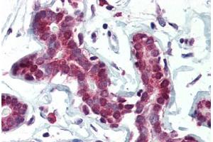 Human Breast (formalin-fixed, paraffin-embedded) stained with SETD7 antibody ABIN364315 at 5 ug/ml followed by biotinylated anti-mouse IgG secondary antibody ABIN481714, alkaline phosphatase-streptavidin and chromogen. (SETD7 Antikörper)