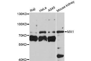 Western blot analysis of extracts of various cell lines, using MX1 antibody (ABIN5970897) at 1:3000 dilution. (MX1 Antikörper)
