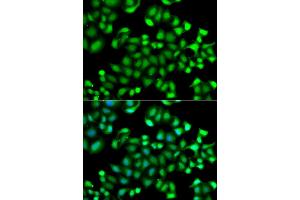 Immunofluorescence analysis of A549 cells using MAPKAPK3 antibody (ABIN5974743). (MAPKAP Kinase 3 Antikörper)
