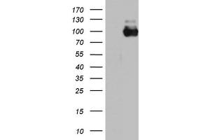 Western Blotting (WB) image for anti-Angiotensin I Converting Enzyme 2 (ACE2) (AA 18-237) antibody (ABIN2715653) (ACE2 Antikörper  (AA 18-237))