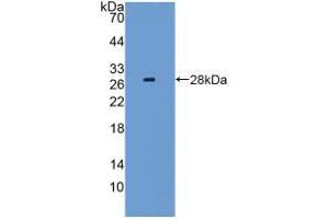 Western blot analysis of recombinant Mouse LAG3. (LAG3 Antikörper  (AA 274-504))