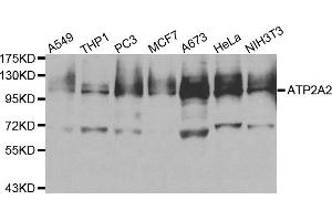 Western blot analysis of extracts of various cell lines, using ATP2A2 antibody. (ATP2A2 Antikörper)