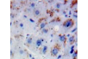 Used in DAB staining on fromalin fixed paraffin-embedded Liver tissue (FGFR2 Antikörper  (AA 157-377))