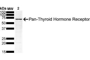 Western Blot analysis of Human Hep G2 Hepatoblastoma Cell lysate showing detection of Thyroid Hormone Receptor protein using Mouse Anti-Thyroid Hormone Receptor Monoclonal Antibody, Clone H43 (ABIN6952044). (THRA Antikörper  (Atto 390))