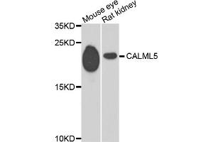 Western blot analysis of extracts of various cell lines, using CALML5 antibody (ABIN5974468) at 1/1000 dilution. (CALML5 Antikörper)