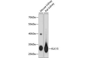 Western blot analysis of extracts of various cell lines, using KLK15 antibody (ABIN3016614, ABIN3016615, ABIN3016616 and ABIN6219799) at 1:3000 dilution. (Kallikrein 15 Antikörper  (AA 80-180))