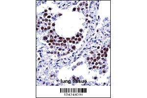 ARIH2 Antibody immunohistochemistry analysis in formalin fixed and paraffin embedded human lung tissue followed by peroxidase conjugation of the secondary antibody and DAB staining. (ARIH2 Antikörper  (C-Term))