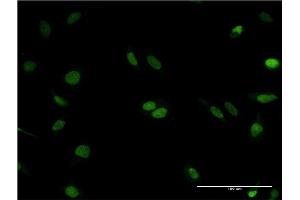 Immunofluorescence (IF) image for anti-Ribonuclease H2, Subunit C (RNASEH2C) (AA 1-164) antibody (ABIN949721)
