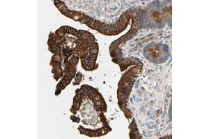 Immunohistochemical staining (Formalin-fixed paraffin-embedded sections) of human colon with SKIL polyclonal antibody  shows strong cytoplasmic and membranous positivity in glandular cells.