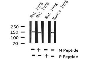 Western blot analysis of Phospho-KIT (Tyr703) expression in various lysates (KIT Antikörper  (pTyr703))