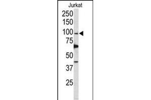 Western Blotting (WB) image for anti-Polymerase (DNA Directed), delta 1, Catalytic Subunit 125kDa (POLD1) (AA 710-739) antibody (ABIN650753)