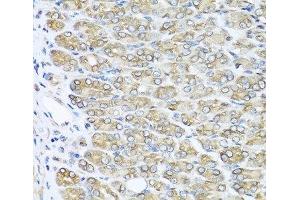 Immunohistochemistry of paraffin-embedded Mouse stomach using RAC2 Polyclonal Antibody at dilution of 1:100 (40x lens). (RAC2 Antikörper)