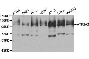 Western blot analysis of extracts of various cell lines, using ATP2A2 antibody. (ATP2A2 Antikörper)