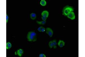 Immunofluorescence staining of MCF-7 cells with ABIN7167184 at 1:100, counter-stained with DAPI. (RASL11B Antikörper  (AA 1-248))