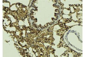 ABIN6268665 at 1/100 staining Mouse lung tissue by IHC-P. (SMAD5 Antikörper  (Internal Region))