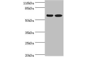 Western blot All lanes: SPATS2L antibody at 8 μg/mL Lane 1: CEM whole cell lysate Lane 2: HepG2 whole cell lysate Secondary Goat polyclonal to rabbit IgG at 1/10000 dilution Predicted band size: 62, 55, 66, 63 kDa Observed band size: 62 kDa (SPATS2L Antikörper  (AA 2-488))